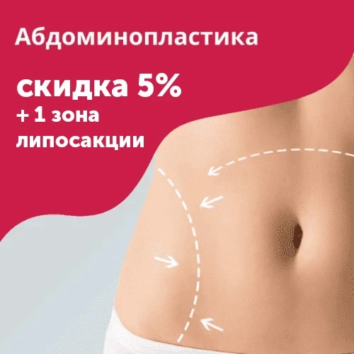 Абдоминопластика со скидкой 5%