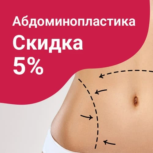 Операция ПХ Абдоминопластика со скидкой 5%