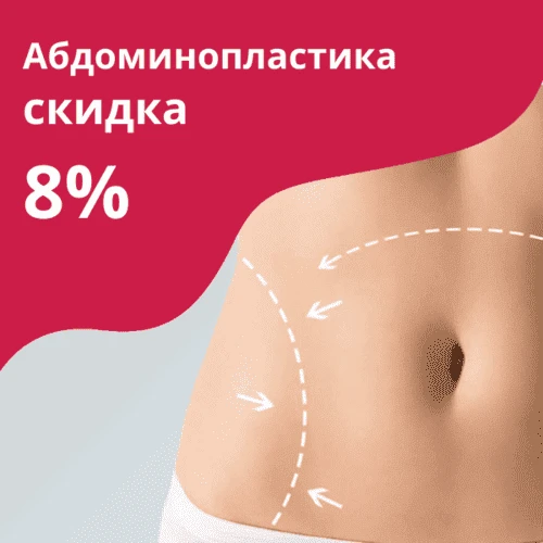 Абдоминопластика со скидкой 8%