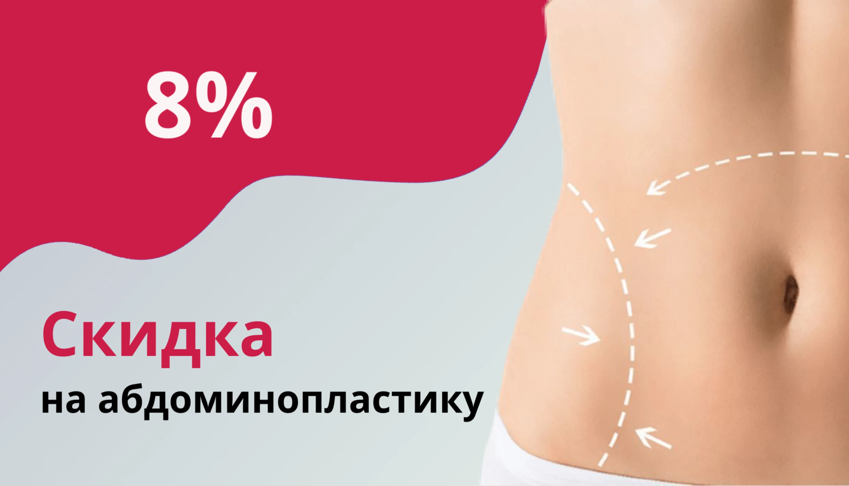 Абдоминопластика со скидкой 8%