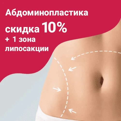 Абдоминопластика со скидкой 10%