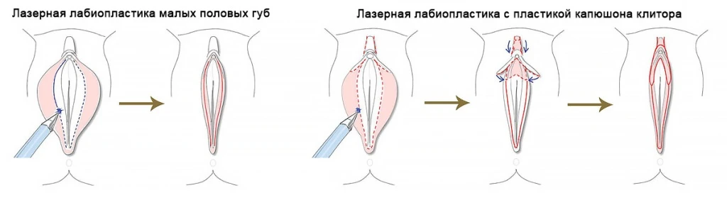 Центр трансгендерной хирургии